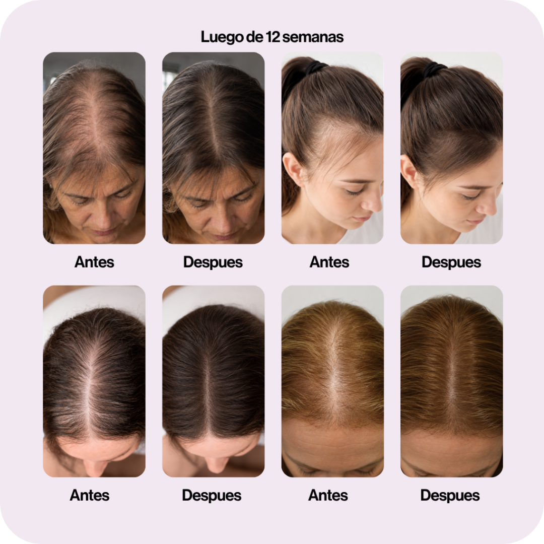 Hair Growth Capsules